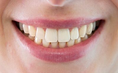 ¿Qué dice la forma de tus dientes sobre tu personalidad?