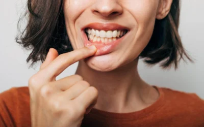 Encías inflamadas: causas más frecuentes y cuándo acudir al dentista