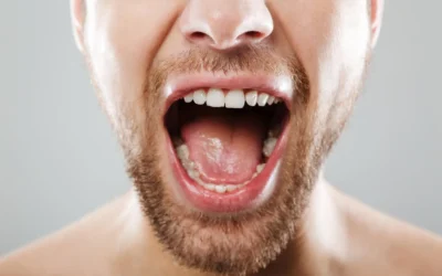 Halitosis: cómo saber si tienes mal aliento y qué puede estar causándolo